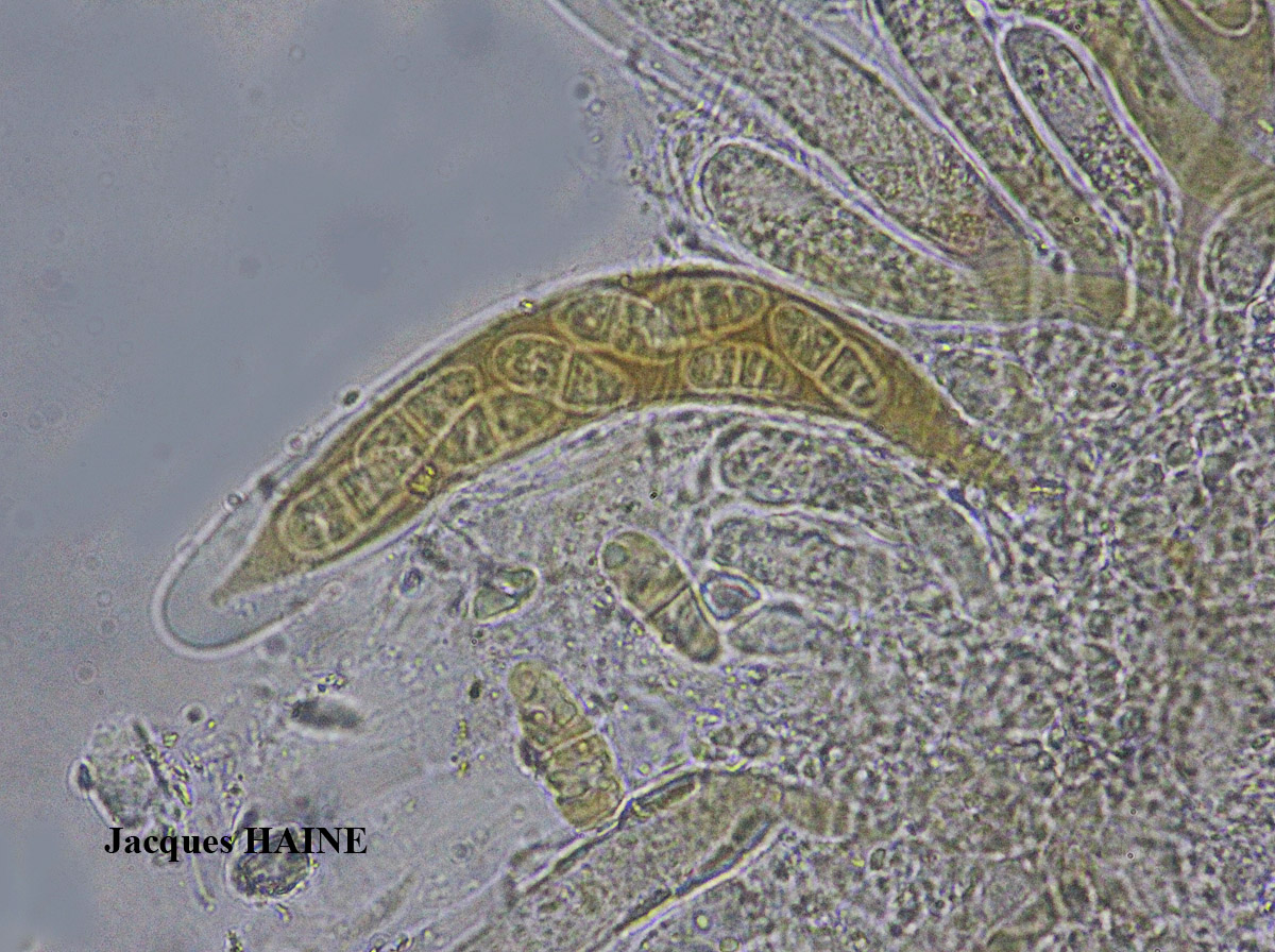 Collemopsidium ostrearum Taxon Atlantique-Manche forme sur Patella.
